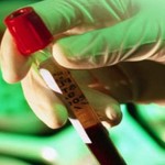 Как и зачем анализируют кровь на ВИЧ-инфекцию